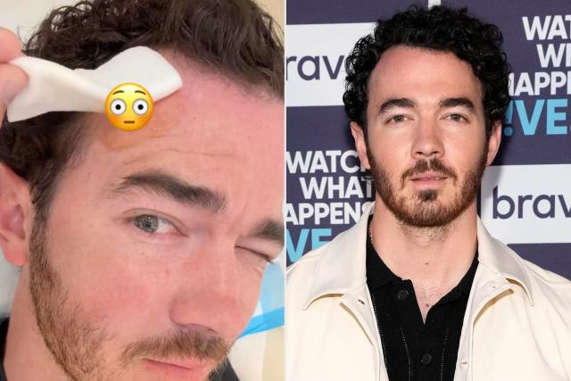 Kevin Jonas revela que padece cáncer de piel