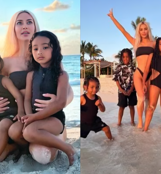 Kim Kardashian reveló que uno de sus hijos padece de vitiligo